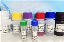 人白细胞介素2ELISA检测试剂盒厂家