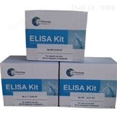 U-TSH试剂盒高灵敏度促甲状腺激素检测试剂盒